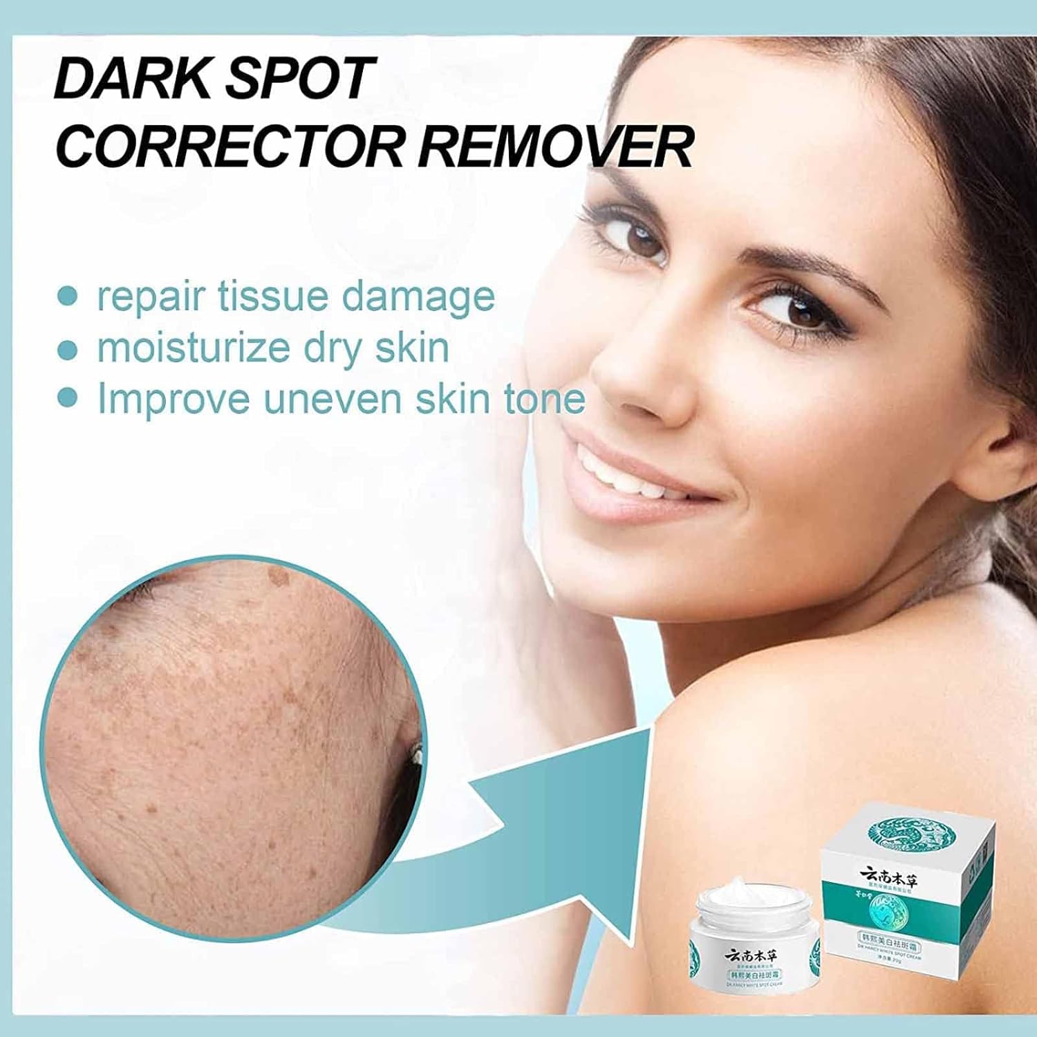 Dr Hancy White Spot Cream,remove Melasma Cream,Spot Off ​Freckle Whitening Cream, Dark Spot Corrector for Face, Skin Care Facial Moisturizer Face Cream for Dry  Sensitive Ski (3PCS)